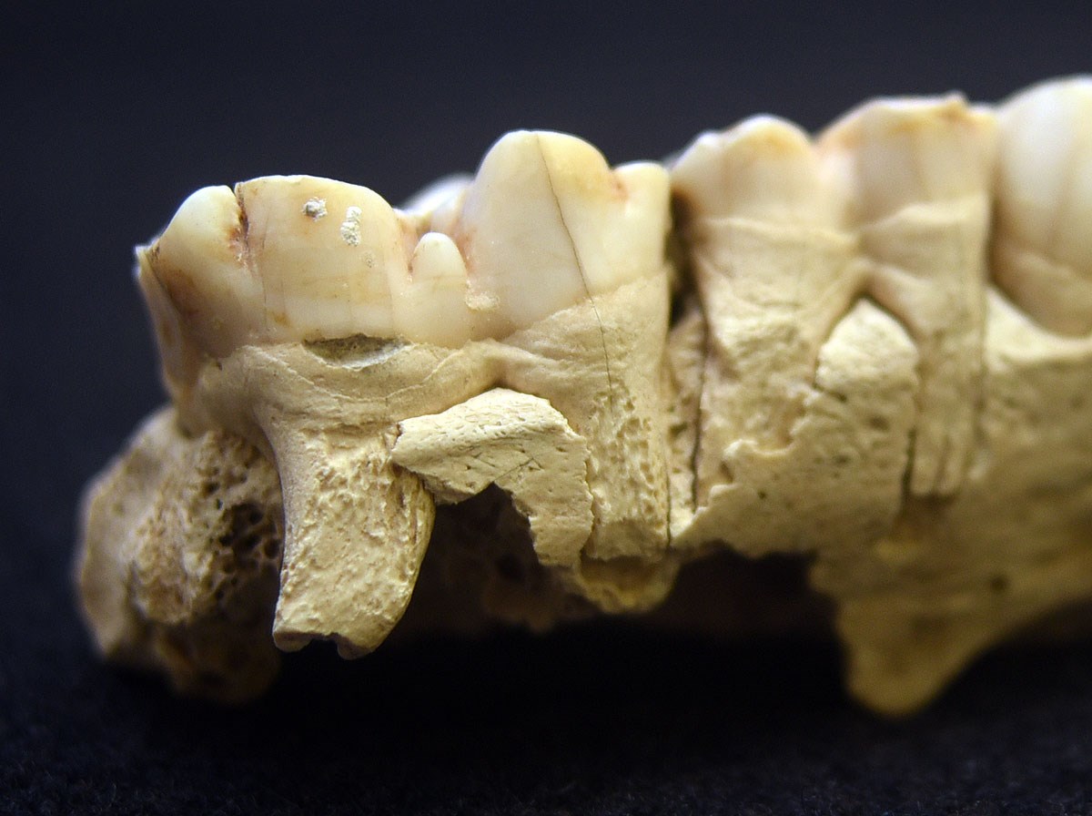 Dental Calculus Archaeology